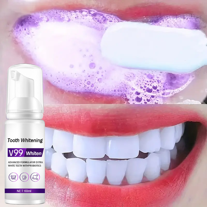 Mousse V99 Pasta do zębów Czys – Teeth Whitening Mousse recenzja i cena