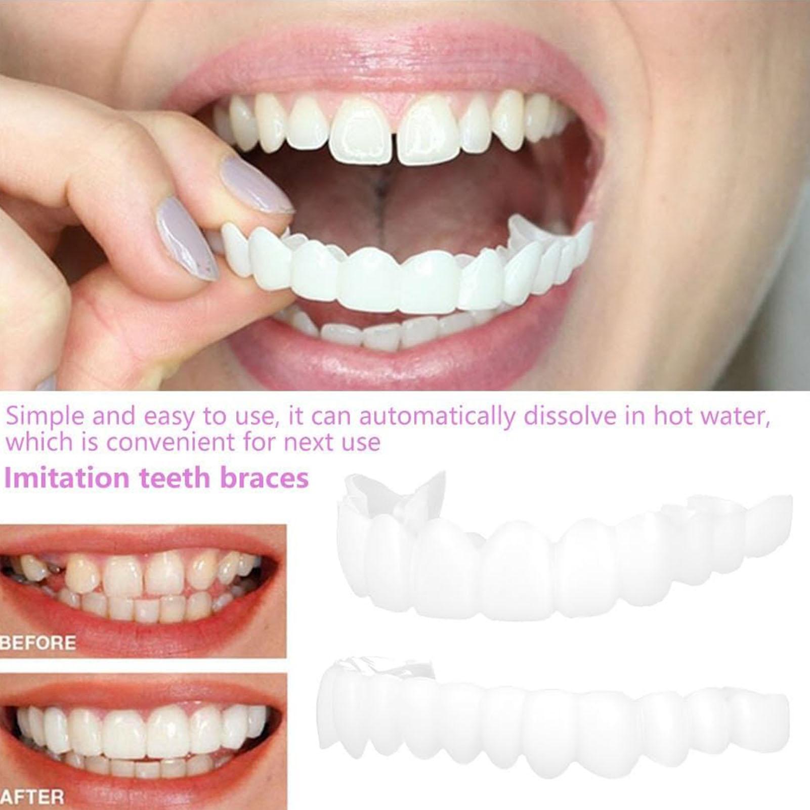 2 szt. Tymczasowe nakładki na  – Teeth Whitening Mask recenzja i cena