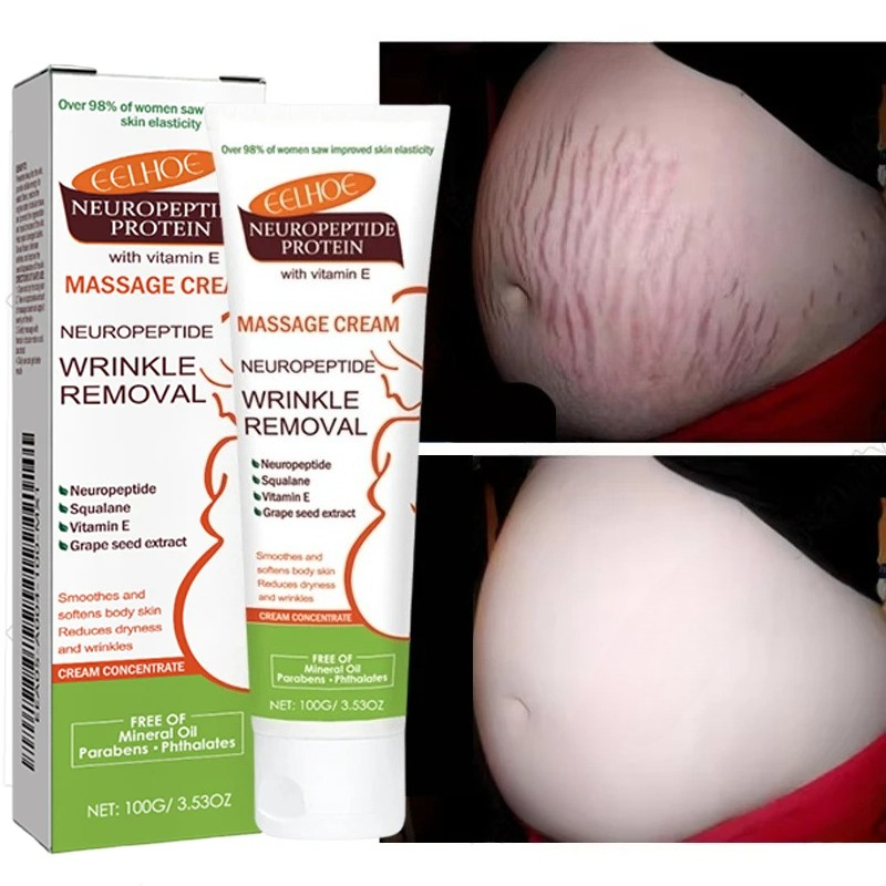 Teeth Whitening Pregnancy - Krem na rozstępy 100g, trwałe usuwanie,
