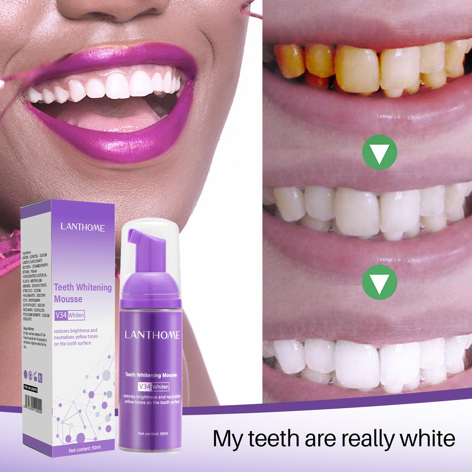 V34 Mus do czyszczenia zębów P – Teeth Whitening Mousse recenzja i cena