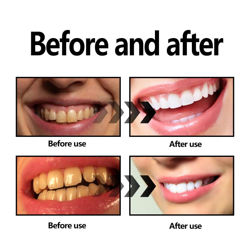 Proszek z węgla bambusowego do – Teeth Whitening Filter recenzja i cena