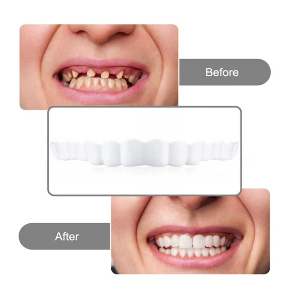 4-6 par protez górnych i dolny – Teeth Whitening Mask recenzja i cena