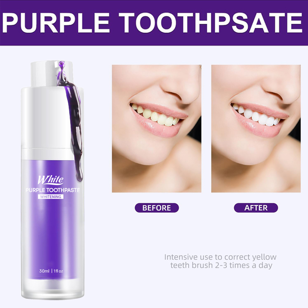 Fioletowa pasta do zębów wybie – Teeth Whitening Treatment recenzja i cena