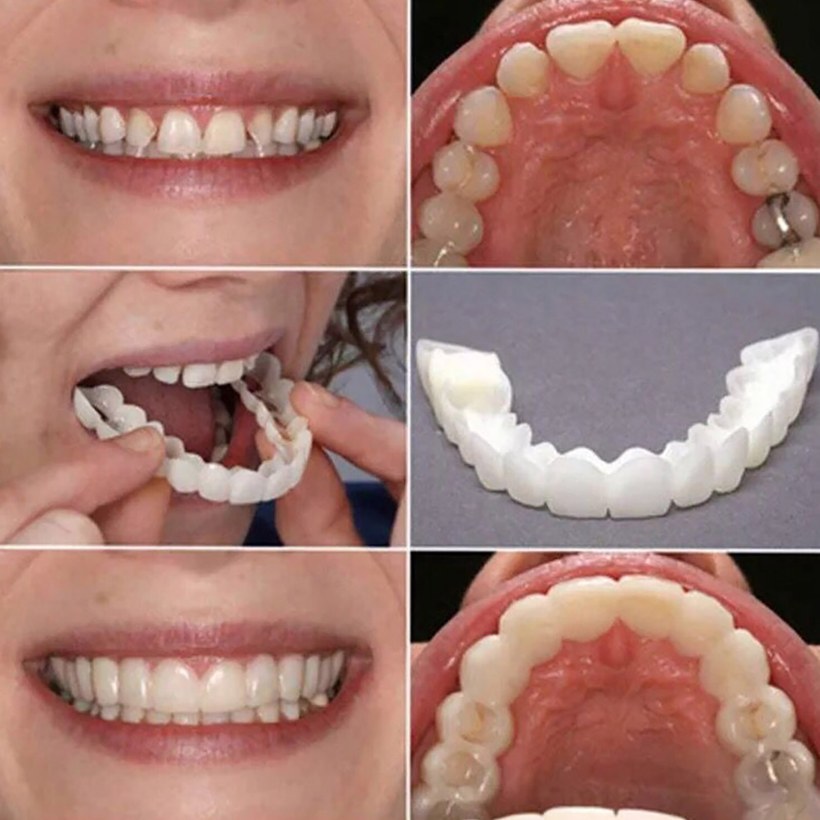 Okładziny na zęby, wybielanie, – Teeth Whitening Mask recenzja i cena