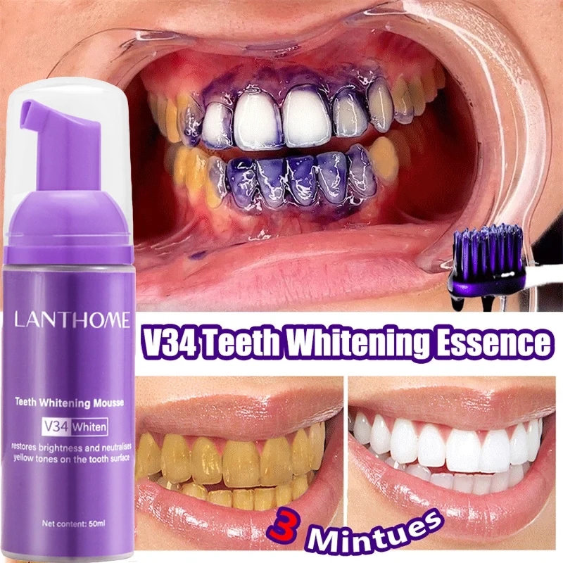 Pasta do zębów w piance V34 do – Teeth Whitening Mousse recenzja i cena