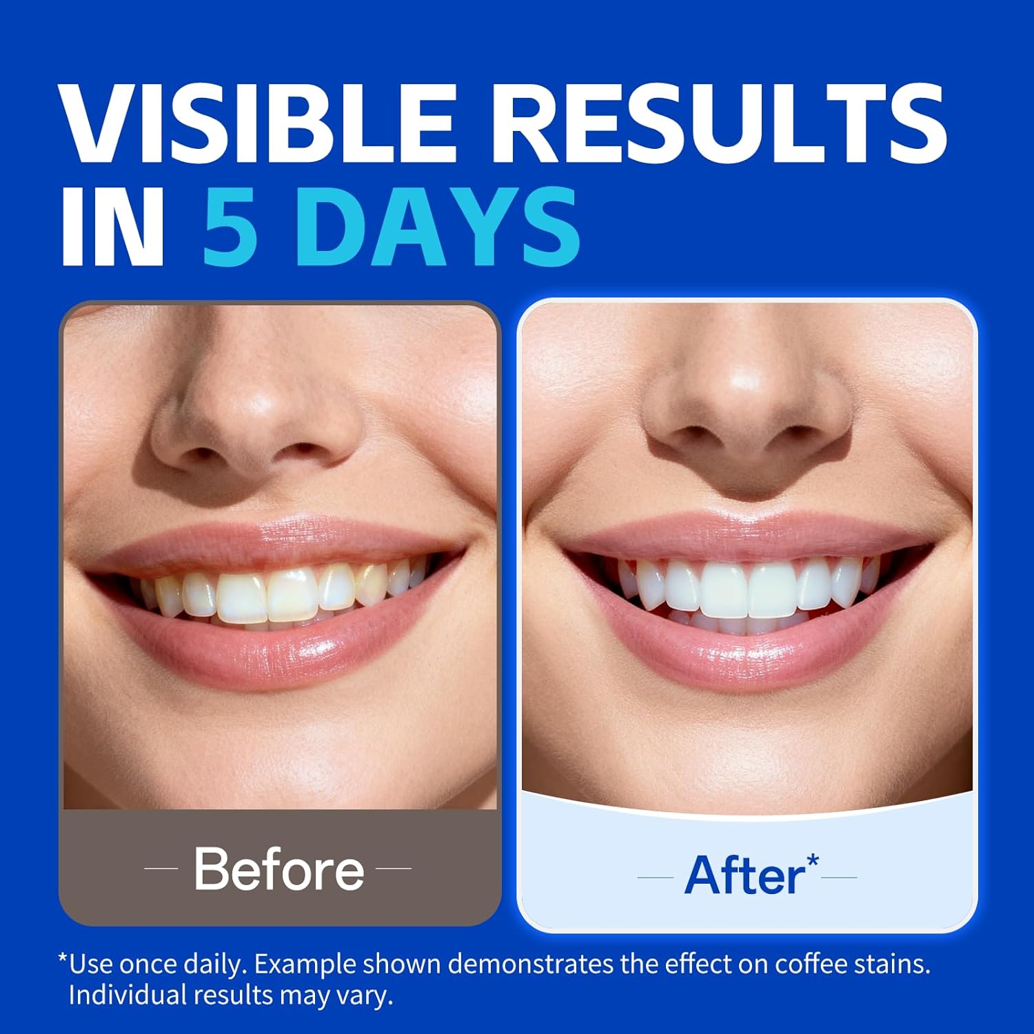 1/7 par Pasków do Wybielania Z – Teeth Whitening Strips Permanent recenzja i cena
