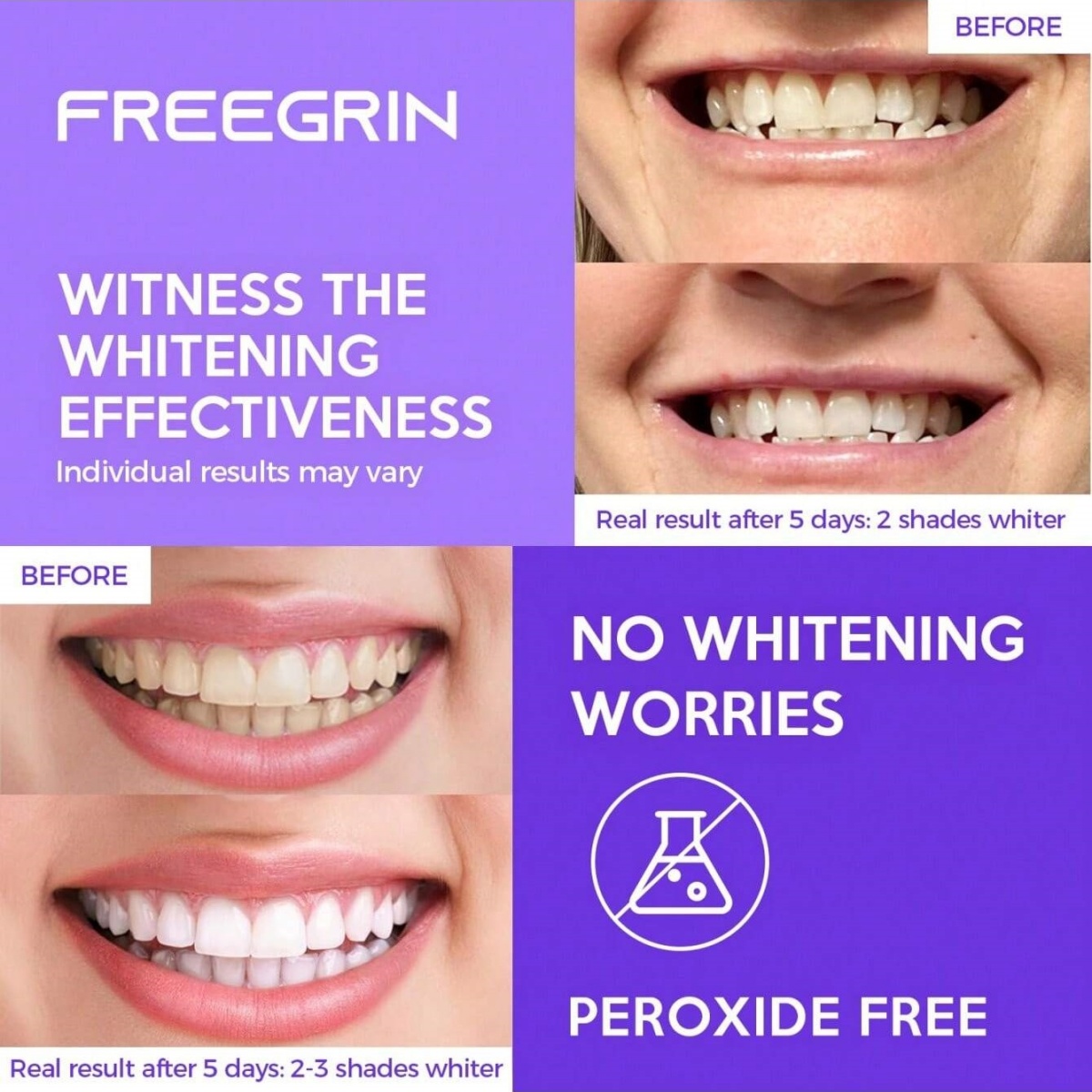 Naklejki wybielające do zębów  – Teeth Whitening Strips Permanent recenzja i cena