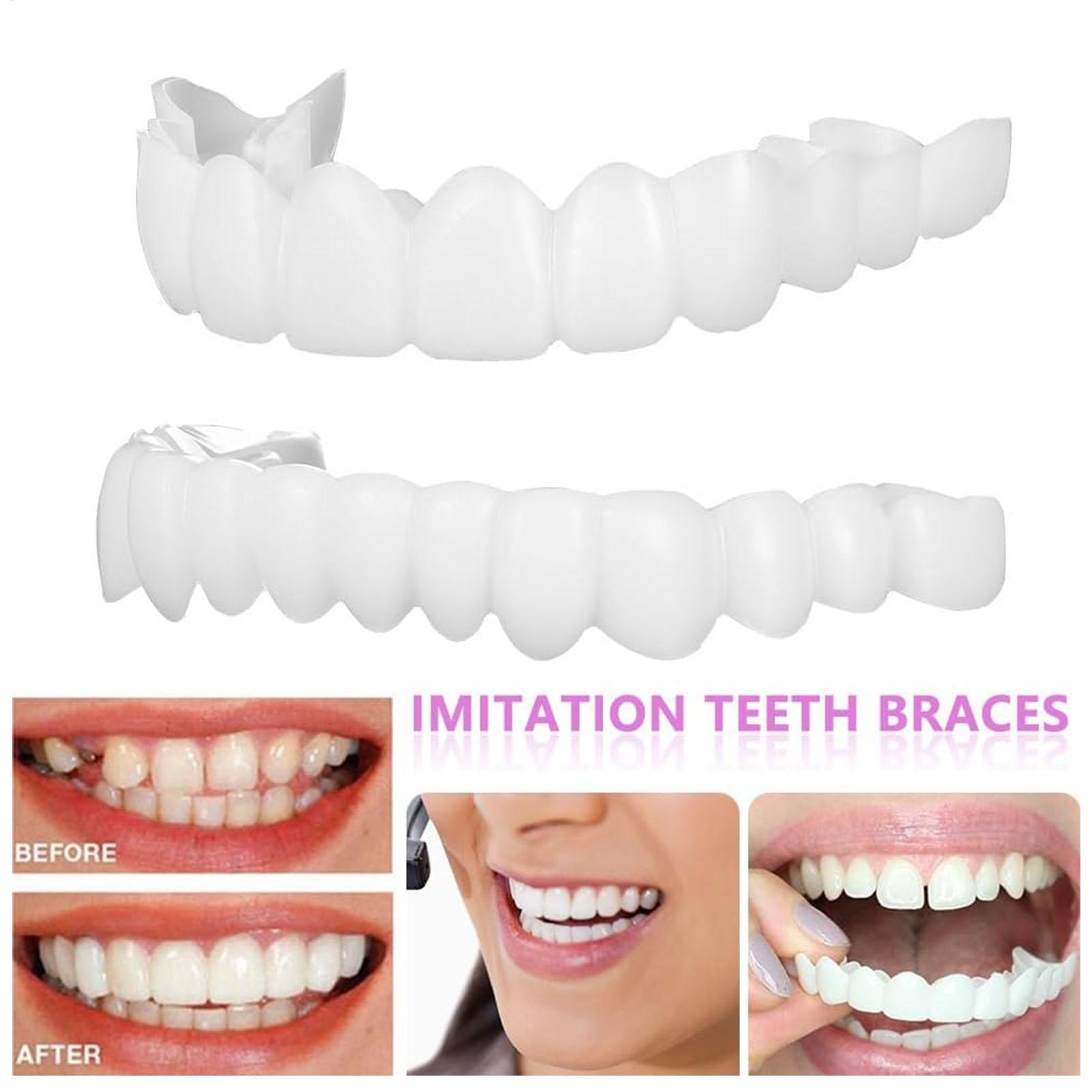 2 szt. Tymczasowe nakładki na  – Teeth Whitening Mask recenzja i cena