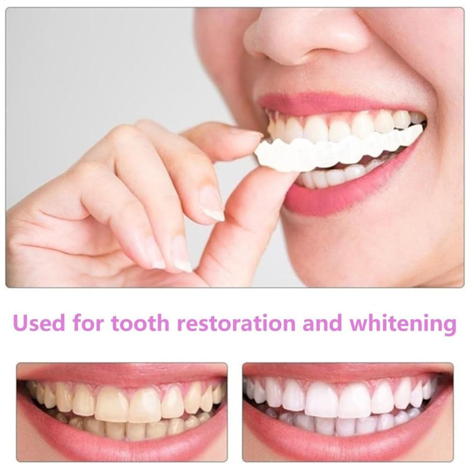 2 szt. Tymczasowe nakładki na  – Teeth Whitening Mask recenzja i cena